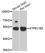 Anti-ATP6V1B2 antibody (262-511) (STJ22729)