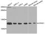 Anti-ATPIF1 antibody (26-106) (STJ22734)