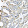 Anti-ATPIF1 antibody (26-106) (STJ22734)