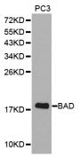 Anti-BAD antibody (50-150) (STJ22755)