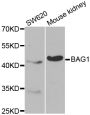 Anti-BAG1 antibody (1-230) (STJ22756)