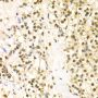 Anti-BAG1 antibody (1-230) (STJ22756)