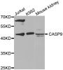 Anti-CASP9 antibody (139-416) (STJ22908)