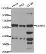 Anti-CCNB1 antibody (334-433) (STJ22943)