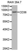 Anti-CD36 antibody (301-400) (STJ22993)