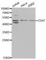 Anti-CD47 antibody (292-304) (STJ23004)
