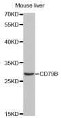 Anti-CD79B antibody (130-229) (STJ23012)