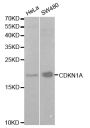Anti-CDKN1A antibody (1-164) (STJ23069)