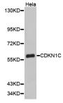 Anti-CDKN1C antibody (1-107) (STJ23075)