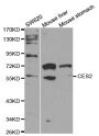Anti-CES2 antibody (310-410) (STJ23101)