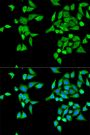 Anti-CES2 antibody (310-410) (STJ23101)