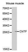 Anti-CNTF antibody (24-74) (STJ23186)