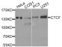Anti-CTCF antibody (1-260) (STJ23259)