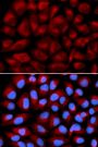 Anti-FANCC antibody (340-558) (STJ23623)