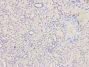 Anti-FAS antibody (200-335) (STJ23628)