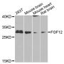 Anti-FGF12 antibody (1-181) (STJ23653)