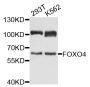 Anti-FOXO4 antibody (230-341) (STJ23706)