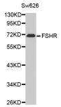 Anti-FSHR antibody (631-695) (STJ23714)