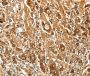 Anti-FSHR antibody (631-695) (STJ23714)