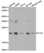 Anti-FTH1 antibody (1-183) (STJ23718)