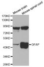 Anti-GFAP antibody (1-75) (STJ23770)