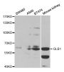 Anti-GLB1 antibody (329-677) (STJ23798)