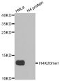 Anti-Mono-Methyl-Histone H4-K20 antibody (STJ23970)