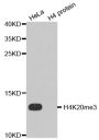Anti-Tri-Methyl-Histone H4-K20 antibody (STJ23972)