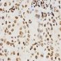 Anti-Histone H3 antibody (36-136) (STJ23980)