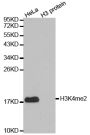 Anti-Di-Methyl-Histone H3-K4 antibody (2-19) (STJ23982)