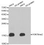 Anti-Di-Methyl-Histone H3-K79 antibody (STJ23994)