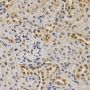Anti-Di-Methyl-Histone H3-K79 antibody (STJ23994)
