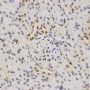 Anti-Tri-Methyl-Histone H3-K79 antibody (STJ23995)