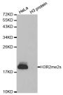 Anti-Di-Methyl-Histone H3-R2 antibody (2-19) (STJ23996)