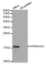 Anti-Di-Methyl-Histone H3-R8 antibody (Around R8) (STJ23997)