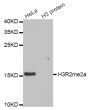 Anti-Di-Methyl-Histone H3-R2 antibody (Around R2) (STJ24011)