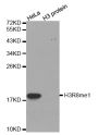 Anti-Mono-Methyl-Histone H3-R8 antibody (STJ24012)