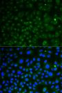 Anti-LAMP1 antibody (150-250) (STJ24368)