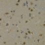 Anti-MAX antibody (1-160) (STJ24508)
