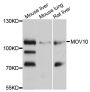 Anti-MOV10 antibody (1-310) (STJ24600)