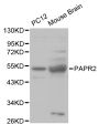 Anti-PRKN antibody (81-280) (STJ24894)