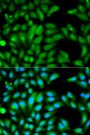 Anti-PRKN antibody (81-280) (STJ24894)