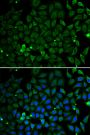 Anti-PRKN antibody (81-280) (STJ24894)