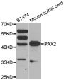 Anti-PAX2 antibody (150-320) (STJ24908)