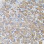 Anti-PIK3CG antibody (1-310) (STJ24995)