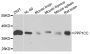 Anti-PPP1CC antibody (1-323) (STJ25082)