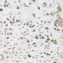 Anti-PPP1CC antibody (1-323) (STJ25082)