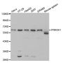 Anti-PRKAA1 antibody (1-300) (STJ25112)