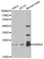 Anti-RAB5A antibody (1-215) (STJ25263)