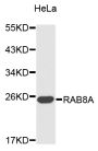 Anti-RAB8A antibody (100-207) (STJ25268)